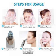 Electric Blackhead Remover – Pore Cleaning & Facial Care Device