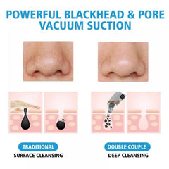 Electric Blackhead Remover – Pore Cleaning & Facial Care Device