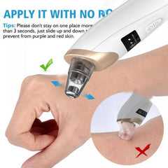 Electric Blackhead Remover – Pore Cleaning & Facial Care Device