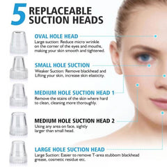 Electric Blackhead Remover – Pore Cleaning & Facial Care Device