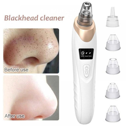 Electric Blackhead Remover – Pore Cleaning & Facial Care Device