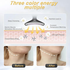 Vegena Electric Face Massager with 3 Modes & 45°C Warm Care